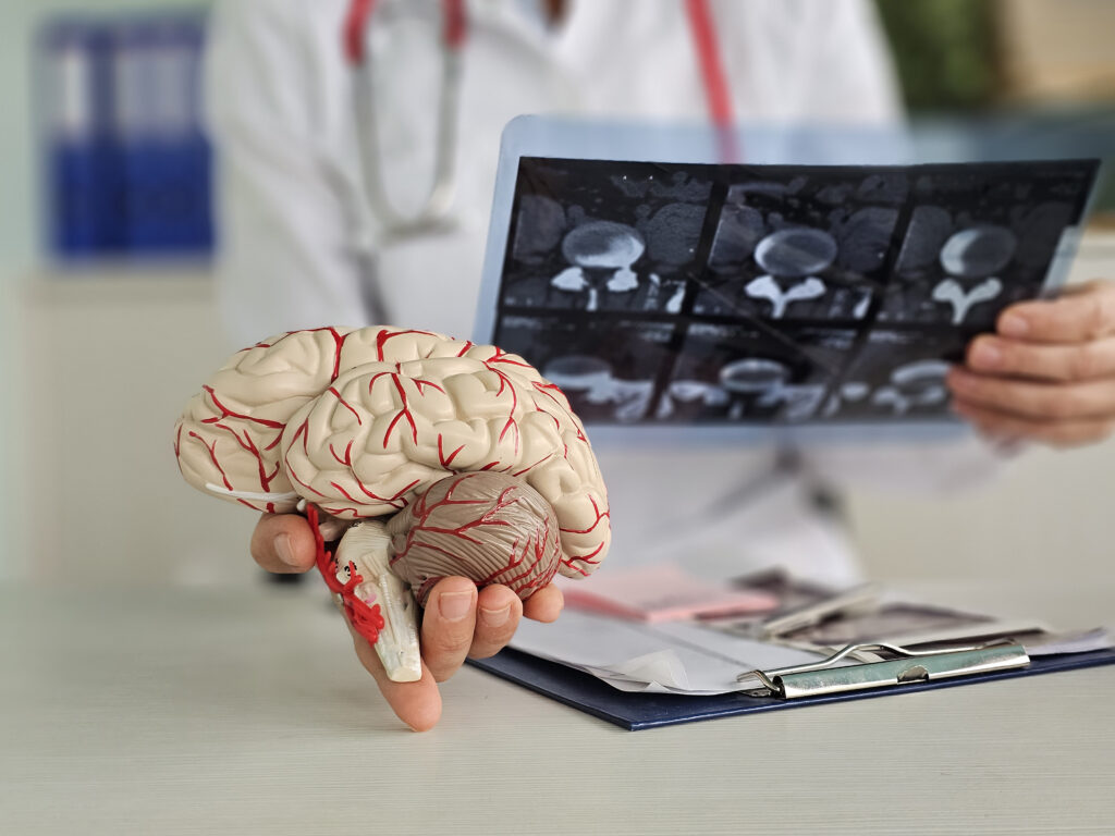 Neurologia