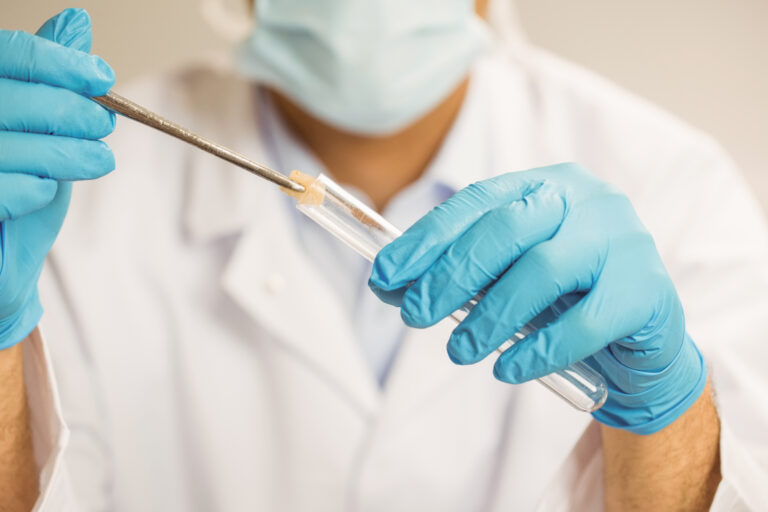 Biopsja – kiedy się ją wykonuje, jakie są rodzaje i ile trwa