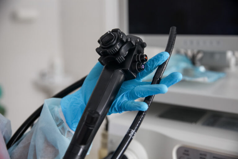 Test ureazowy (Helicobacter pylori) – co to jest i jak odczytać wynik